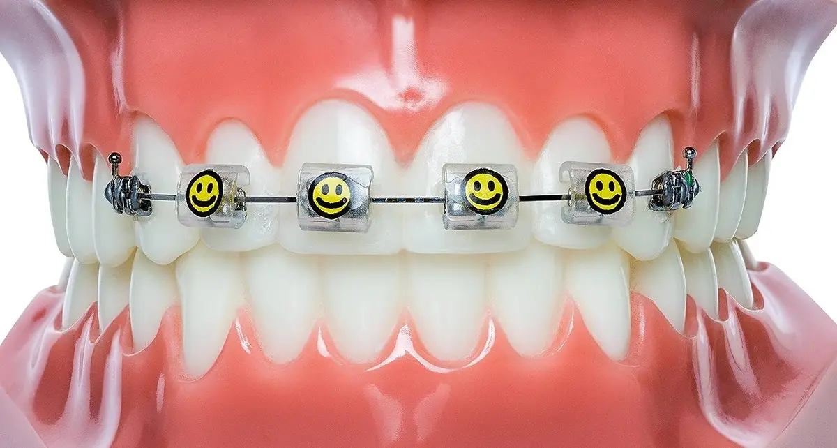 Dental Bracket Cover
