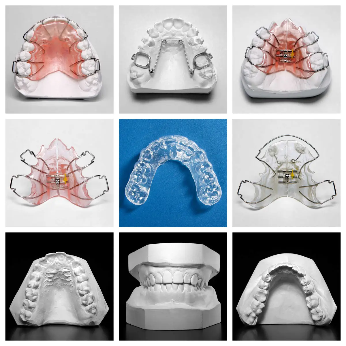Dental Retainer