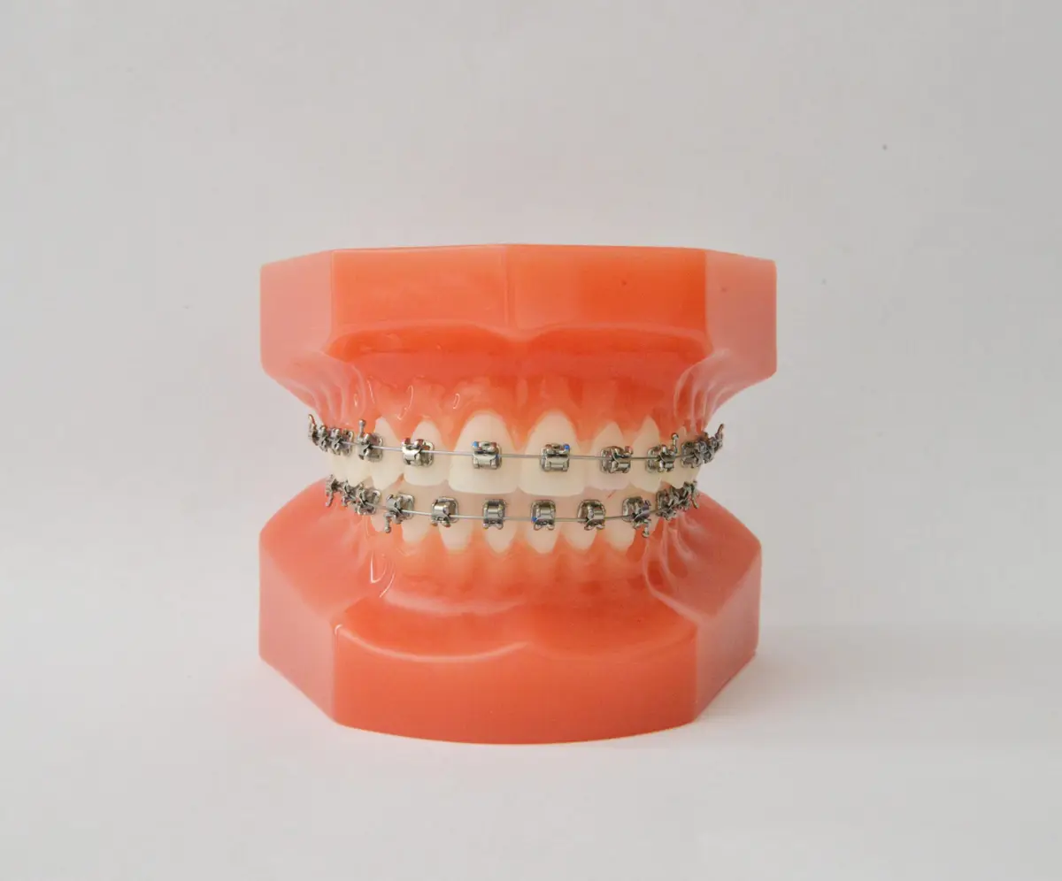 Self Ligating Bracket Biosurgico orthodontic dental bracket low friction stainless steel system Self Ligating Bracket Biosurgico orthodontic dental bracket low friction stainless steel system
