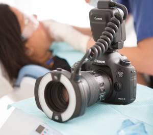 Digital Camera Extra Oral