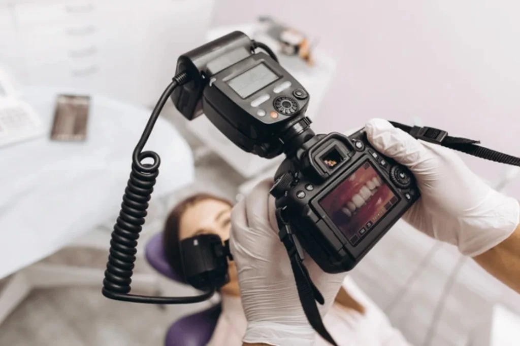 Digital Camera Extra Oral: Revolutionizing Dental Imaging with Ebiosurgico