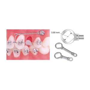 Closed Coil Spring Braces - NiTi Orthodontic Spring